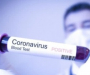 У Сумській області 12 людей захворіли на коронавірус